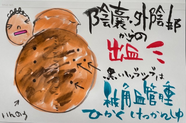 どのように扱われますか?